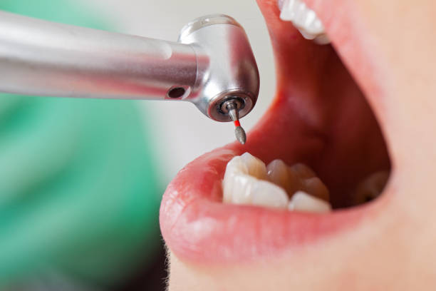 Best Pediatric Emergency Dentist in Geneva, FL